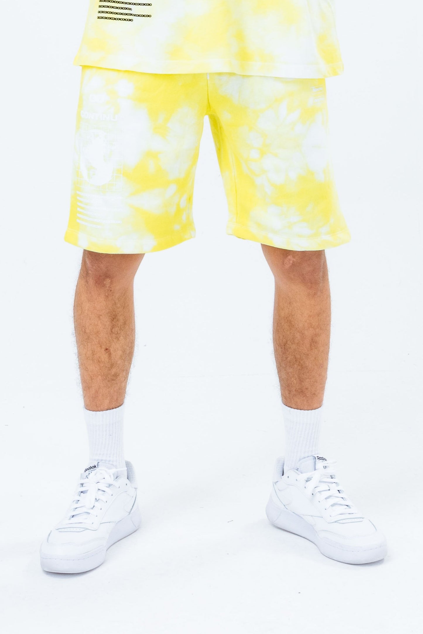 CONTINU8 YELLOW TIE DYE JERSEY SHORTS